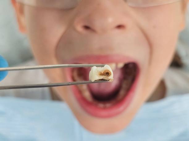 Best Pediatric Emergency Dentist in Leland, NC